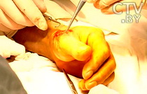 Травматология и ортопедия: лечение травм и болезней рук