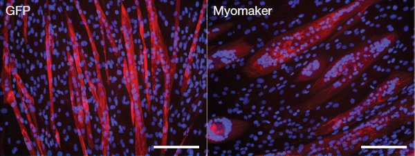     Рис. 4. Сравнение клеточной линии С1С12 с дополнительными копиями гена миомейкера (справа, Myomaker) и без них (слева, GFP). Изображение из обсуждаемой статьи в Nature