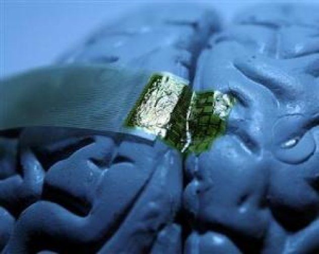 brain-neural-implant