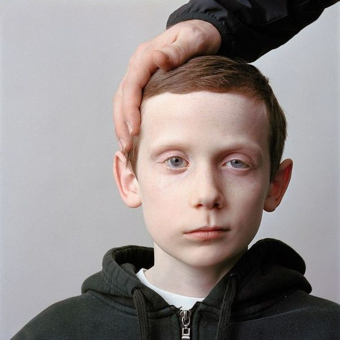 About Face: фотопортреты людей, страдающих параличом