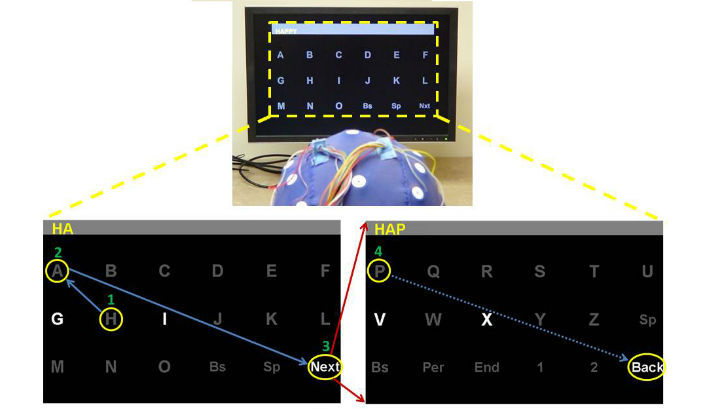 Нейрокомпьютерный интерфейс помог пациенту с синдромом запертого человека пообщаться с родными