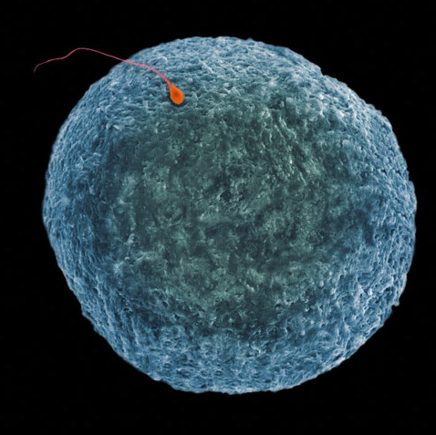Встреча человеческого сперматозоида и человеческой яйцеклетки. (Фото Dennis Kunkel Microscopy, Inc. / Visuals Unlimited / Corbis.) Подробнее см.: http://www.nkj.ru/news/26252/ (Наука и жизнь, Человеческому эмбриону поправили геном)