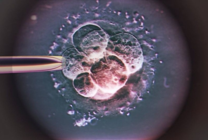 Замена дефектных митохондрий у человеческого эмбриона может предотвратить передачу некоторых наследственных заболеваний. (фото: Zephyr / Science Photo Library)