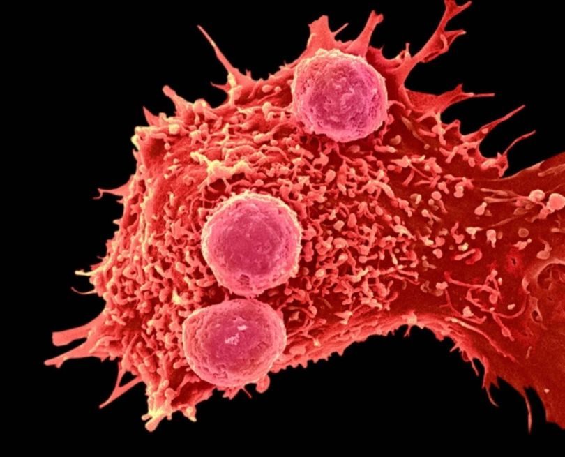 Модифицированные с помощью CRISPR-Cas9 иммунные клетки получают возможность лучше атаковать опухоль. Рисунок с сайта Nature.