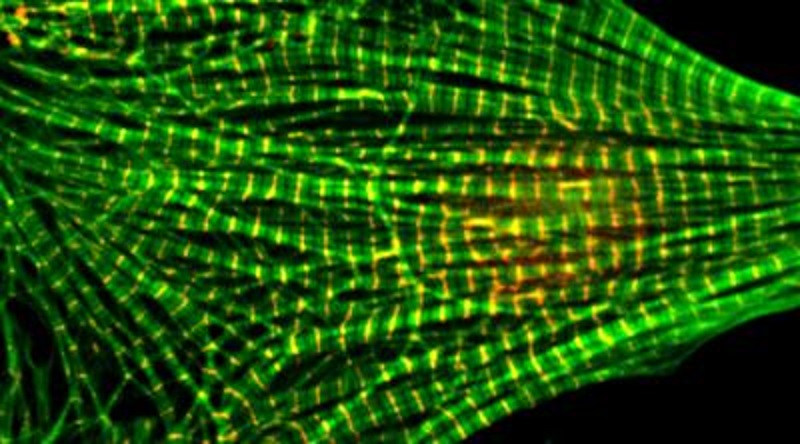 Клетки сердечной мышцы под микроскопом. Зеленые узоры показывают актиновые филаменты. Фото: news.wsu.edu