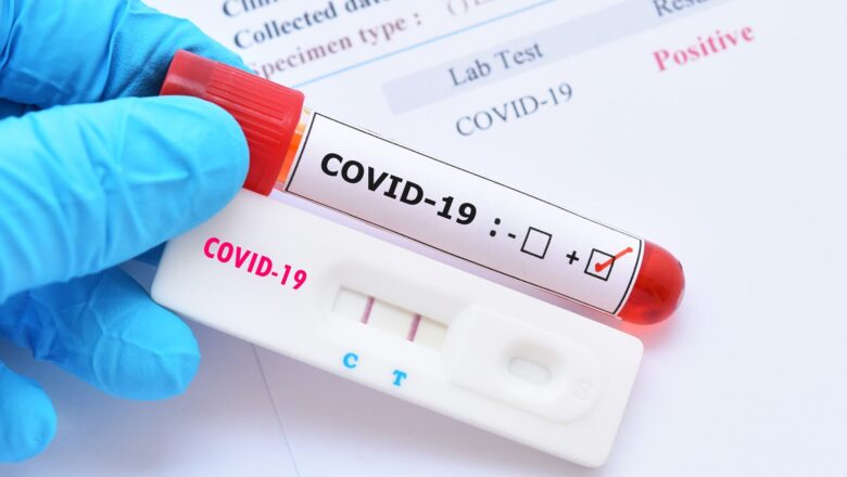 COVID-19: Как не запутаться в тестах на антитела?